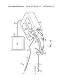 PHYSIOLOGICAL SENSOR DELIVERY DEVICE AND METHOD diagram and image