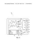 PHYSIOLOGICAL SENSOR DELIVERY DEVICE AND METHOD diagram and image