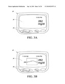 SYSTEMS AND METHODS FOR REPLACING SIGNAL ARTIFACTS IN A GLUCOSE SENSOR DATA STREAM diagram and image