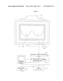 MAMMOGRAPHIC APPARATUS diagram and image