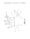 Cast protector diagram and image