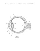 OCULAR IMPLANT WITH THERAPEUTIC AGENTS AND METHODS THEREOF diagram and image