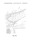 OCULAR IMPLANT WITH THERAPEUTIC AGENTS AND METHODS THEREOF diagram and image