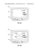 SYSTEM AND METHODS FOR PROCESSING ANALYTE SENSOR DATA diagram and image