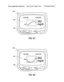 SYSTEM AND METHODS FOR PROCESSING ANALYTE SENSOR DATA diagram and image