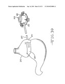 Injection Port Applier with Downward Force Actuation diagram and image