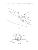 Devices and Methods For Occluding a Flexible Tube diagram and image