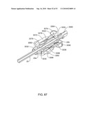 Devices and Methods For Occluding a Flexible Tube diagram and image