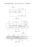 Systems and Methods for Treating Septal Defects diagram and image