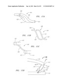 Systems and Methods for Treating Septal Defects diagram and image