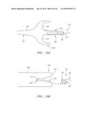 Systems and Methods for Treating Septal Defects diagram and image