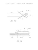 Systems and Methods for Treating Septal Defects diagram and image