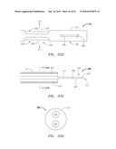 Systems and Methods for Treating Septal Defects diagram and image