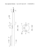 Systems and Methods for Treating Septal Defects diagram and image