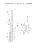 Systems and Methods for Treating Septal Defects diagram and image