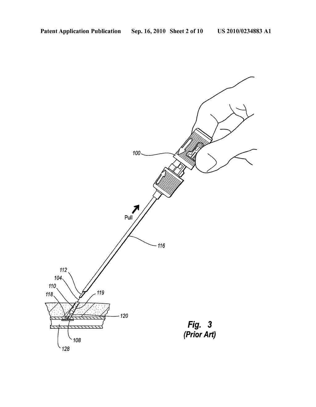 FLEXIBLE TAMPING DEVICE - diagram, schematic, and image 03