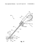 FLEXIBLE TAMPING DEVICE diagram and image