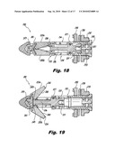 Interspinous Process Implant and Fusion Cage Spacer diagram and image