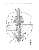 Interspinous Process Implant and Fusion Cage Spacer diagram and image