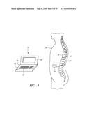 SYSTEM AND METHOD FOR UNIFORMLY DISPLACING A REGION OF NEURAL STIMULATION diagram and image