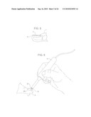 TREATMENT OF MICROBIOLOGICAL PATHOGENS IN A TOE NAIL WITH ANTIMICROBIAL LIGHT diagram and image