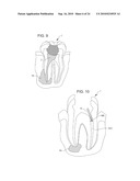 TREATMENT OF MICROBIOLOGICAL PATHOGENS IN A TOE NAIL WITH ANTIMICROBIAL LIGHT diagram and image