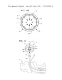 TREATMENT OF MICROBIOLOGICAL PATHOGENS IN A TOE NAIL WITH ANTIMICROBIAL LIGHT diagram and image