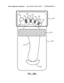 TREATMENT OF MICROBIOLOGICAL PATHOGENS IN A TOE NAIL WITH ANTIMICROBIAL LIGHT diagram and image