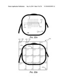 TREATMENT OF MICROBIOLOGICAL PATHOGENS IN A TOE NAIL WITH ANTIMICROBIAL LIGHT diagram and image