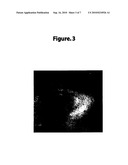 Treatment of Vitiligo diagram and image