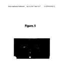 Treatment of Vitiligo diagram and image