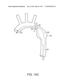 SYSTEM AND METHOD FOR DEPLOYING AN ENDOLUMINAL PROSTHESIS AT A SURGICAL SITE diagram and image