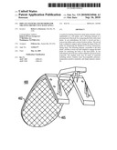 IMPLANT SYSTEMS AND METHODS FOR TREATING OBSTRUCTIVE SLEEP APNEA diagram and image