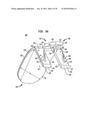 IMPLANT SYSTEMS AND METHODS FOR TREATING OBSTRUCTIVE SLEEP APNEA diagram and image