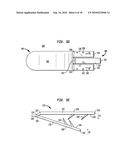 IMPLANT SYSTEMS AND METHODS FOR TREATING OBSTRUCTIVE SLEEP APNEA diagram and image