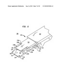 IMPLANT SYSTEMS AND METHODS FOR TREATING OBSTRUCTIVE SLEEP APNEA diagram and image