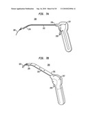 IMPLANT SYSTEMS AND METHODS FOR TREATING OBSTRUCTIVE SLEEP APNEA diagram and image