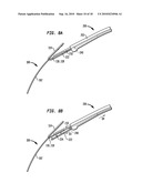 IMPLANT SYSTEMS AND METHODS FOR TREATING OBSTRUCTIVE SLEEP APNEA diagram and image