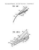 IMPLANT SYSTEMS AND METHODS FOR TREATING OBSTRUCTIVE SLEEP APNEA diagram and image