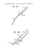 IMPLANT SYSTEMS AND METHODS FOR TREATING OBSTRUCTIVE SLEEP APNEA diagram and image