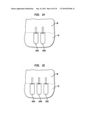 IMPLANT SYSTEMS AND METHODS FOR TREATING OBSTRUCTIVE SLEEP APNEA diagram and image