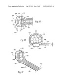 Bundle tie with head dampener diagram and image