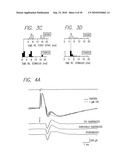 Method and Apparatus for Visual Neural Stimulation diagram and image