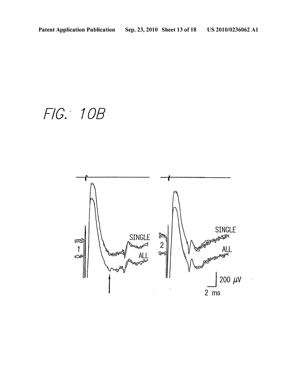 Method and Apparatus for Visual Neural Stimulation - diagram, schematic, and image 14