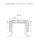 CLOSURE OF VESSEL diagram and image