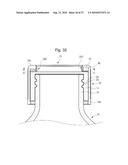 CLOSURE OF VESSEL diagram and image