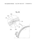 CLOSURE OF VESSEL diagram and image