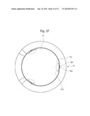 CLOSURE OF VESSEL diagram and image