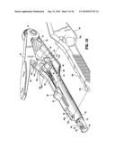 End-To-End Anastomosis Instrument and Method for Performing Same diagram and image