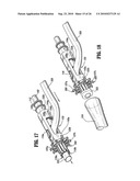 End-To-End Anastomosis Instrument and Method for Performing Same diagram and image